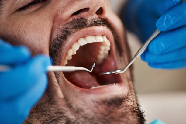 Best Tooth Infection Emergency Dentist  in Shelby, OH